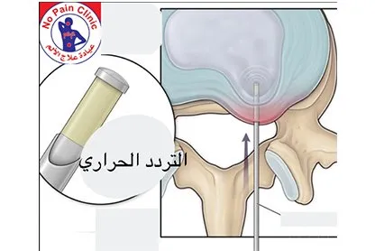 د.رامز عبد المسيح - عيادة علاج الألم